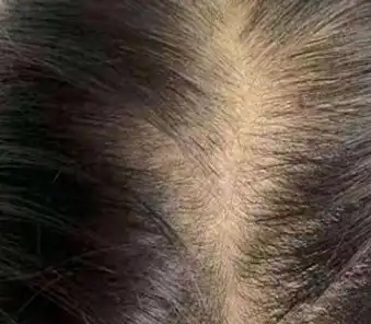 Fleece Flower Root That Benefit Hair